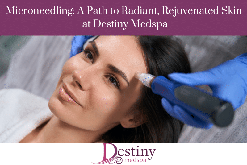 1740168828 Microneedling A Path to Radiant Rejuvenated Skin at Destiny Medspa