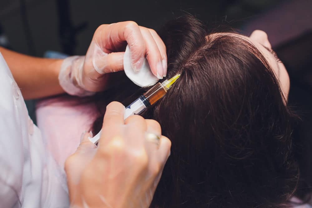 1740168958 platelet rich plasma injection procedure hair growth stimulation prp therapy process 1