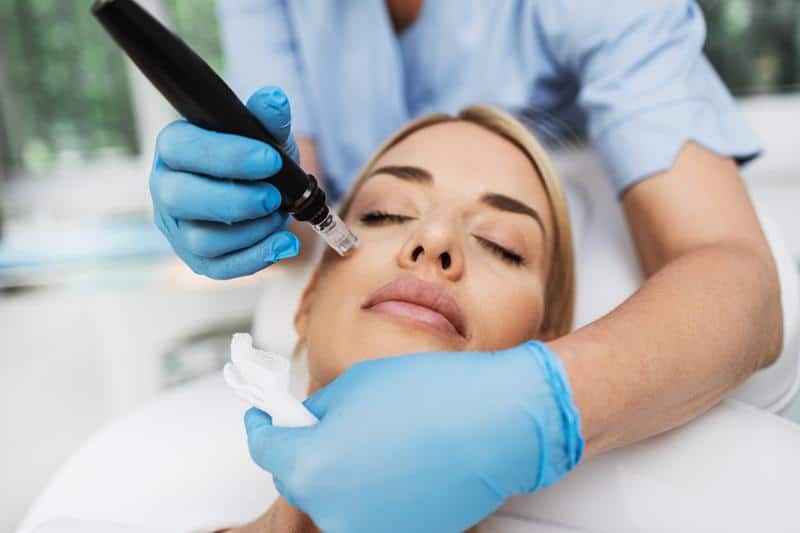 1740169492 prp microneedling facial