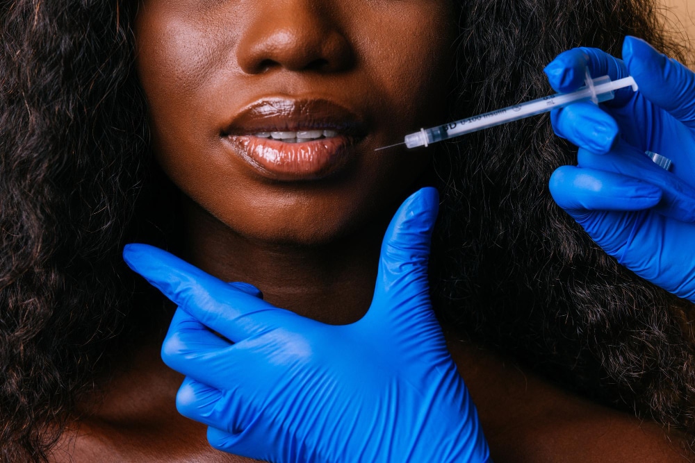 1740169559 lip filler black woman