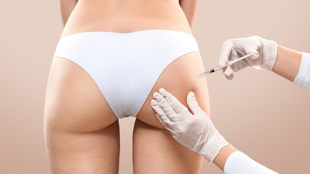 Close-up of plastic surgeon performing Sculptra butt lift injection on slim woman in beauty clinic, showing non-surgical body contouring treatment.